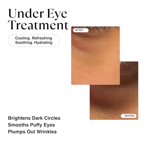 MATKAS Vitamin C Eye Cream 30ml for Puffiness and Dark Circle Reduction - Image 2