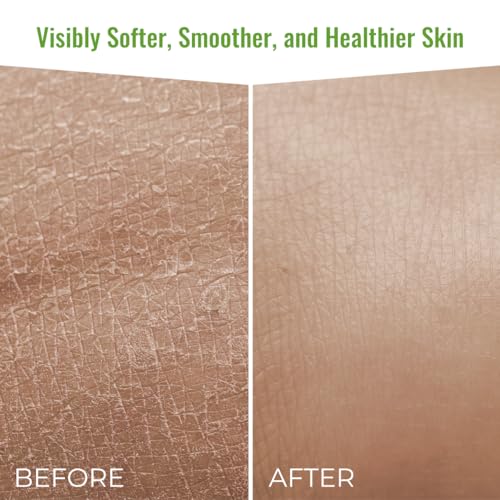 Organic Moisturizing Body Wash for Sensitive, Itchy Skin - Image 8