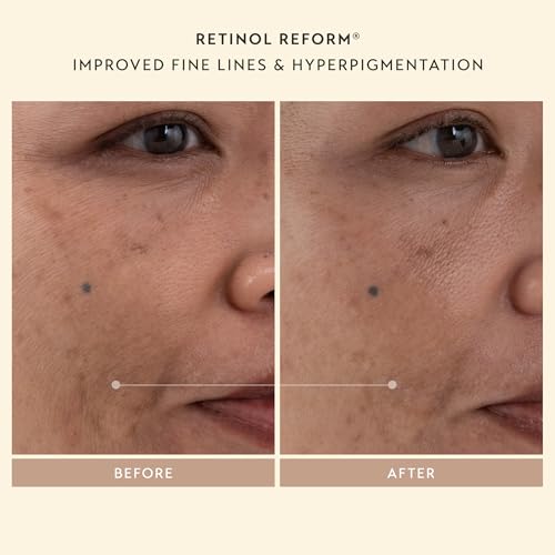 Shani Darden Skincare Renewal Trio Set Retinol Cream and Eye Cream 3-Piece - Image 3