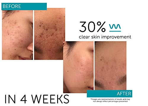 Regenerative Stem Cell Serum for Skin Renewal, Travel Size 30ml - Image 4