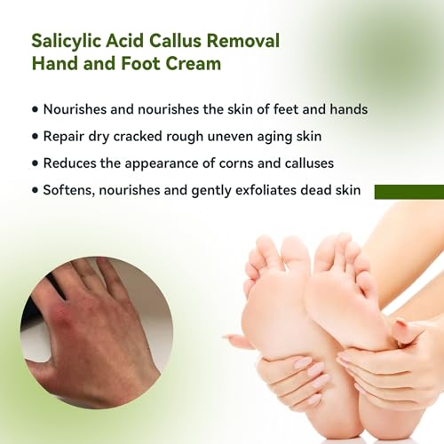 Urea 42% Salicylic Acid Hand Foot Cream for Cracks - Image 5