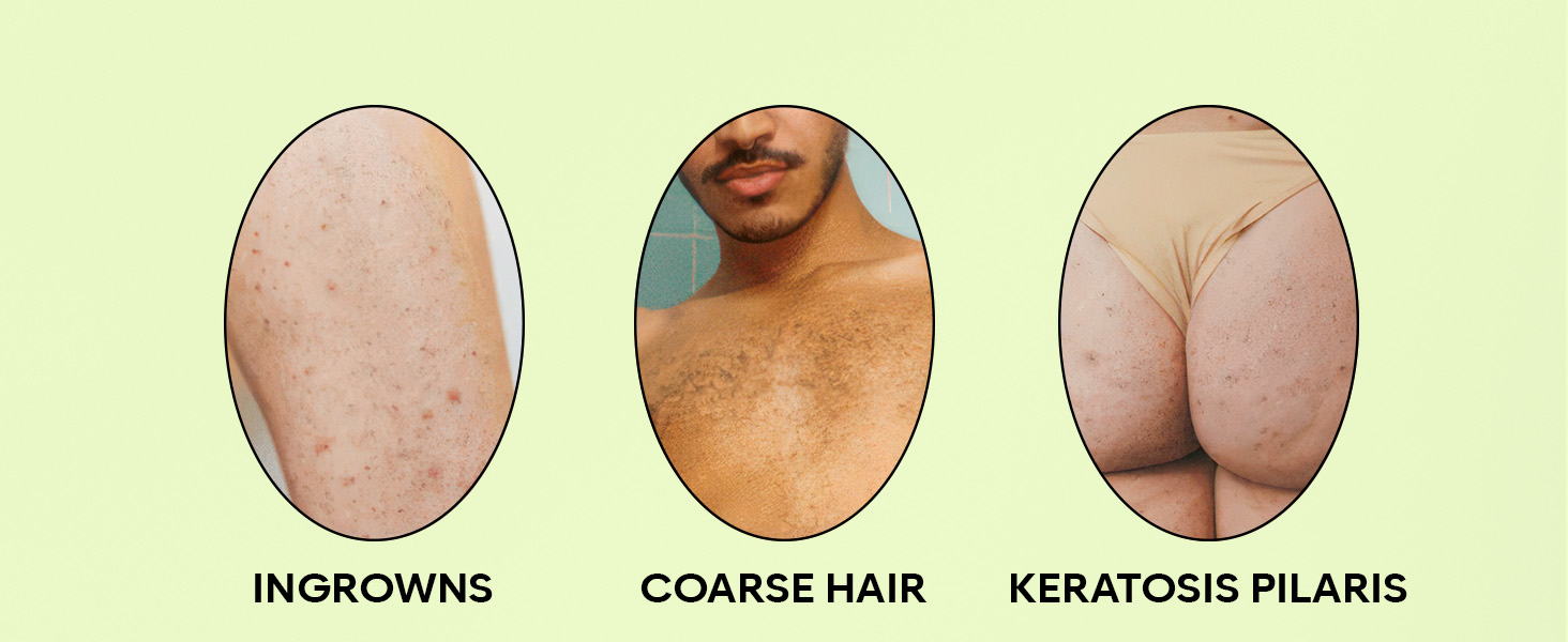 fur oil ingrown hair treatment prevention women men