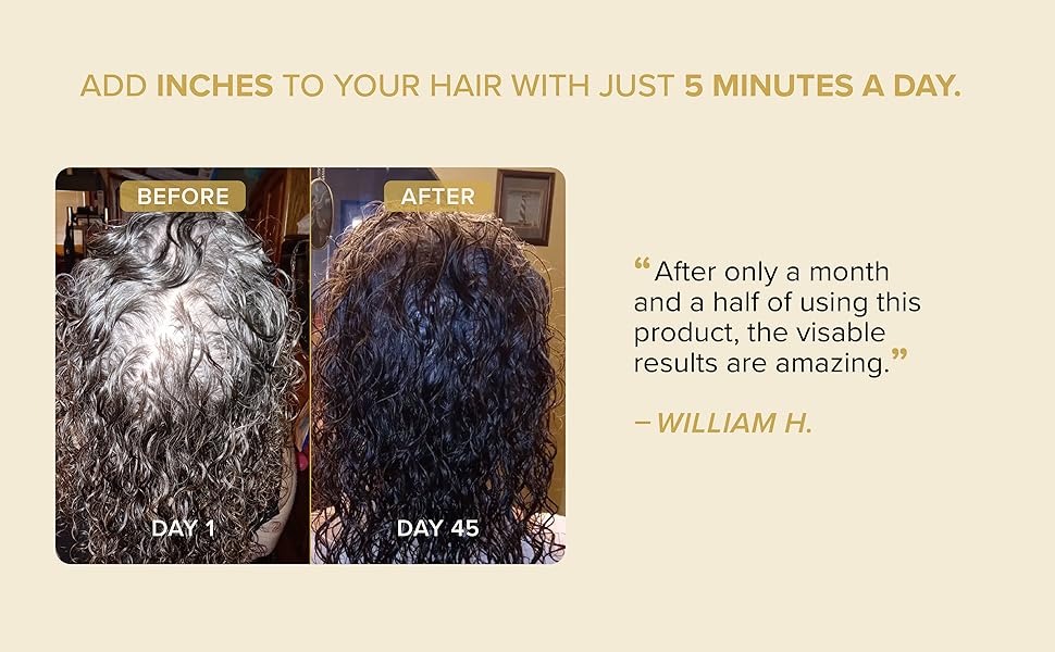 Before and After