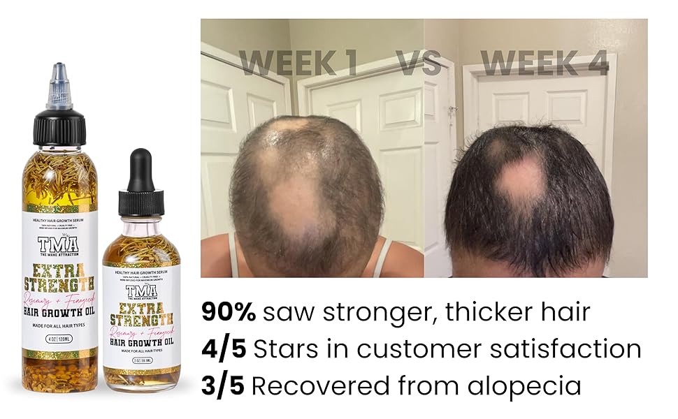 Hair Growth Oil