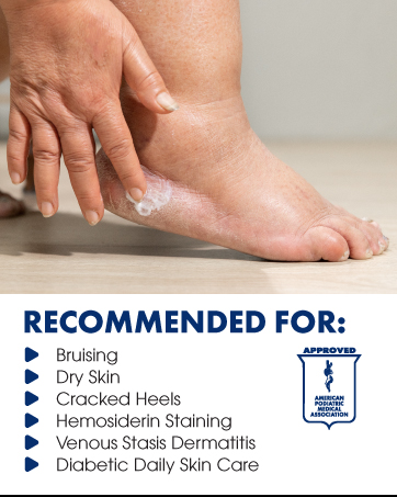 Recommended for bruising, dry skin, cracked heels venous stasis, diabetic skin