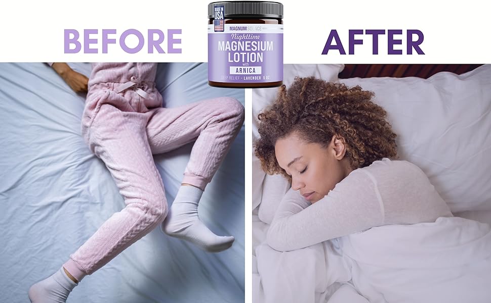 magnesium lotion with arnica
