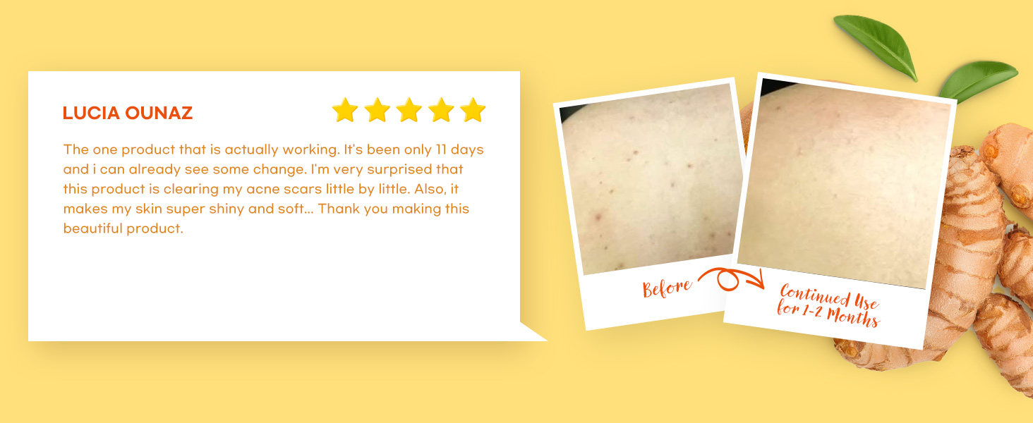 turmeric and kojic soap bar
