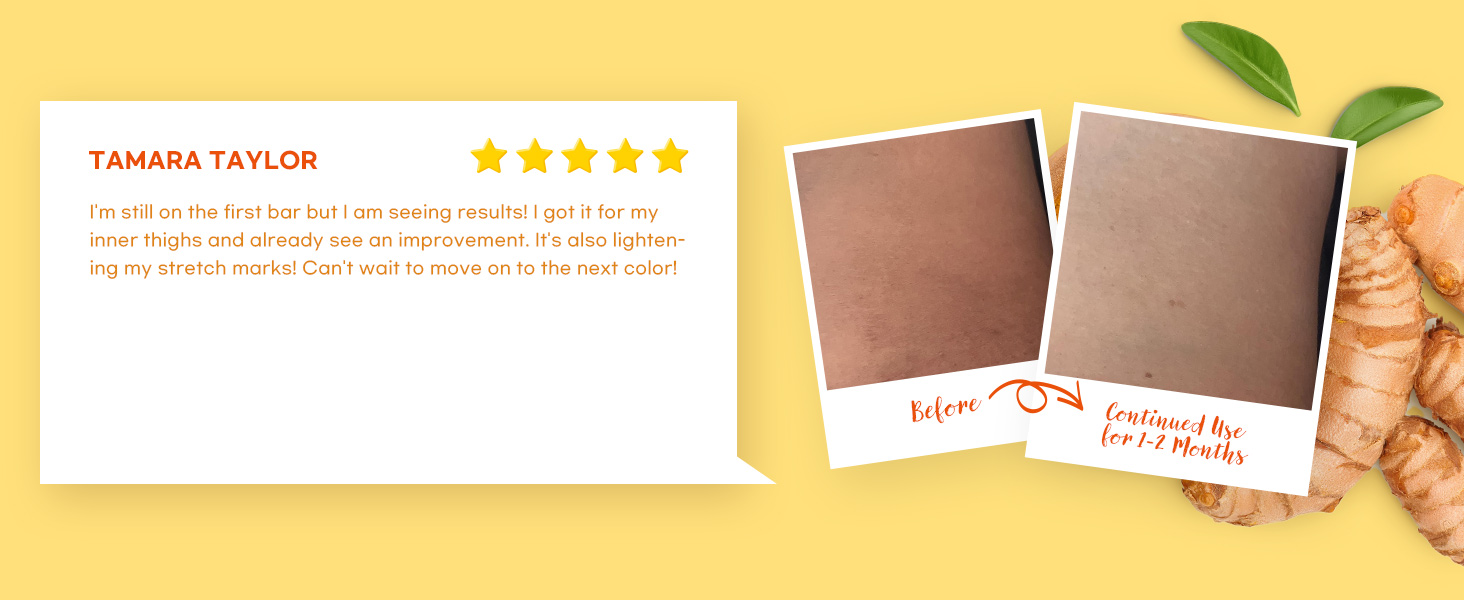 turmeric kojic acid soap