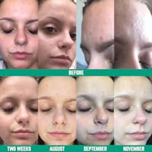 Face Wash for Women Product