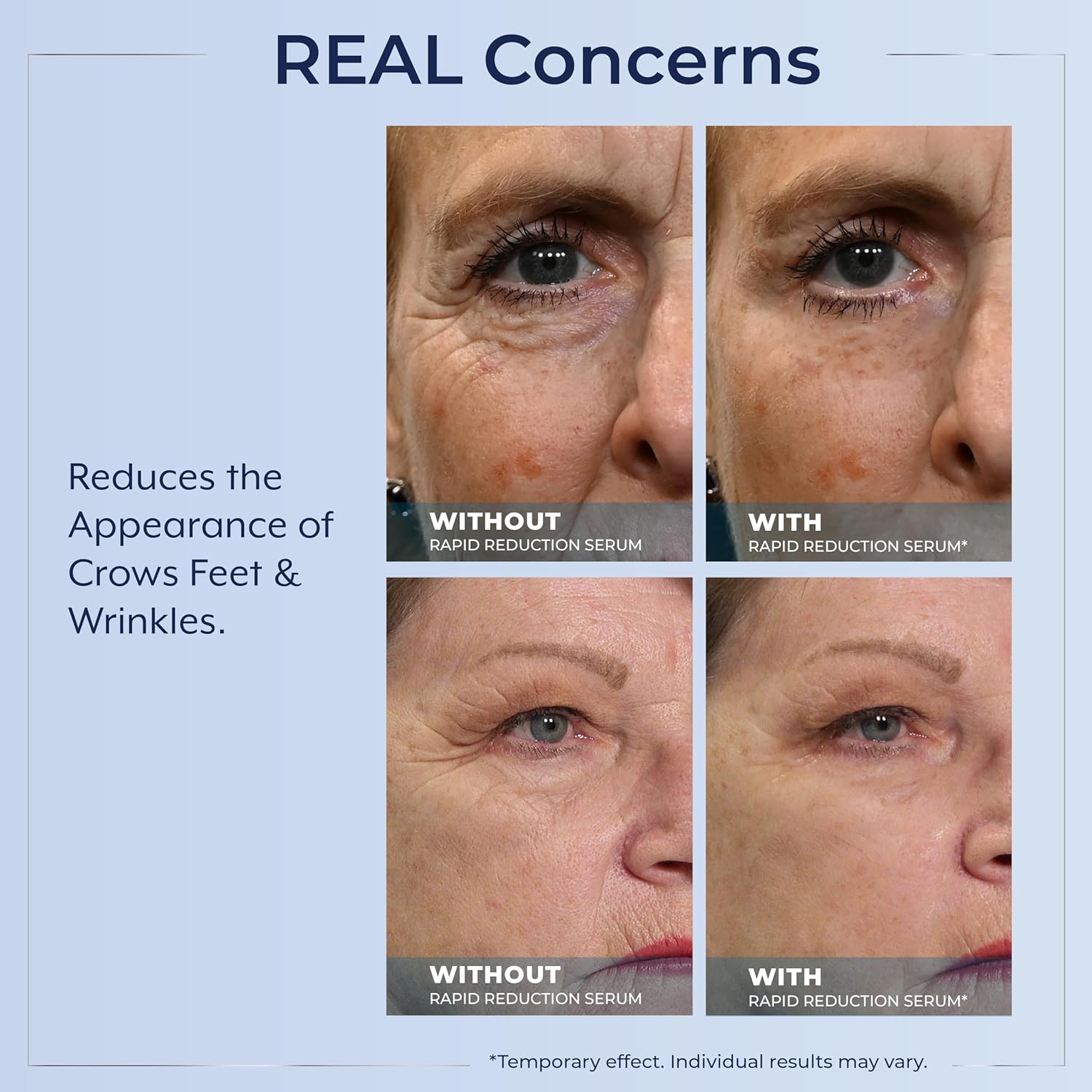 Plexaderm Rapid Reduction Eye Serum - Visibly Reduces Under-Eye Bags, Wrinkles, Dark Circles, Fine Lines & Crow's Feet Instantly, Anti Aging Wrinkle Remover for Face, 30 Single Use Pods - Image 5