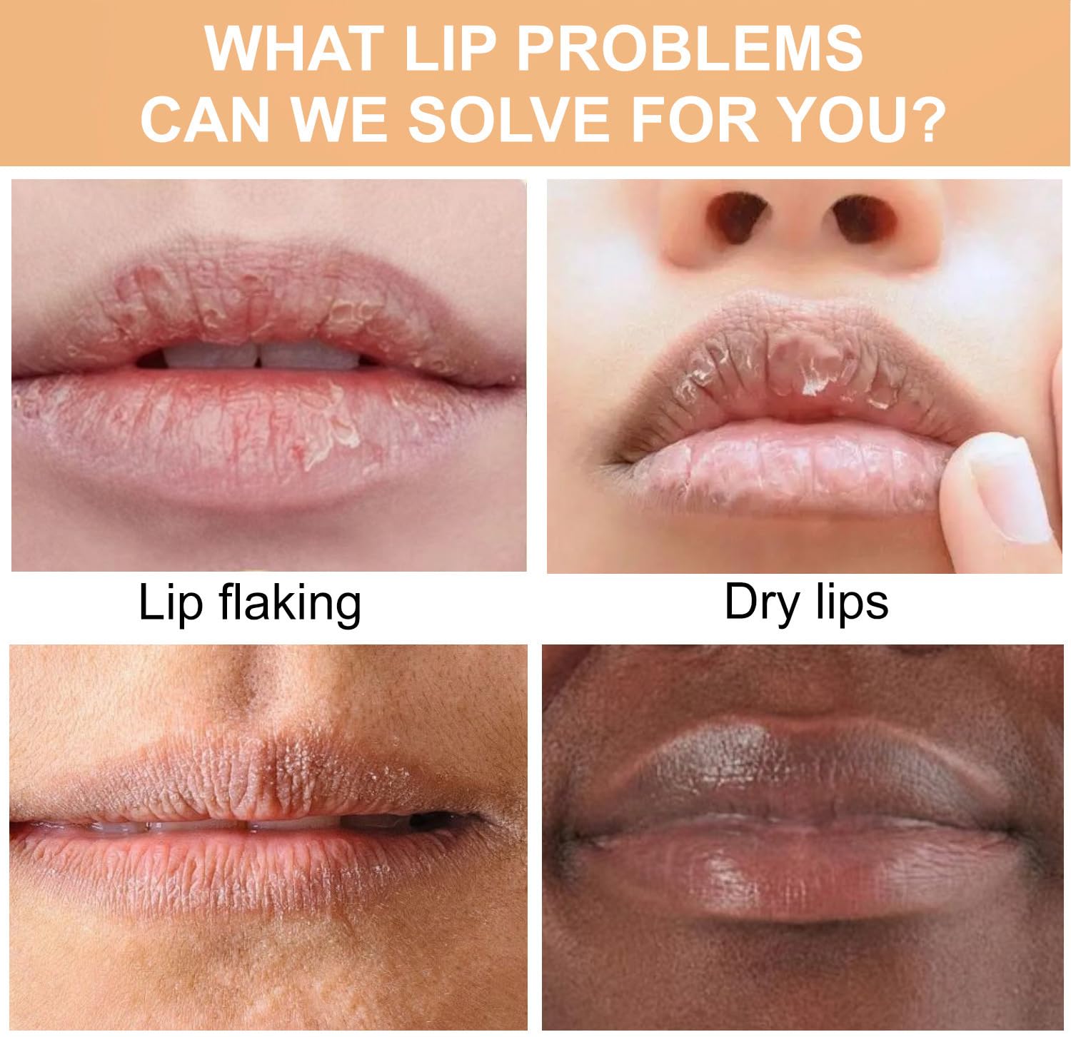 Turmeric Lip Balm for Dark Lips, Lip Balm for Dark Lips, Dark Lips Treatment for Smokers, Lip Exfoliator for Lip Softening & Hydration, Help Fade Lip Discoloration (1) - Image 6