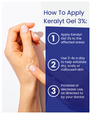 gel