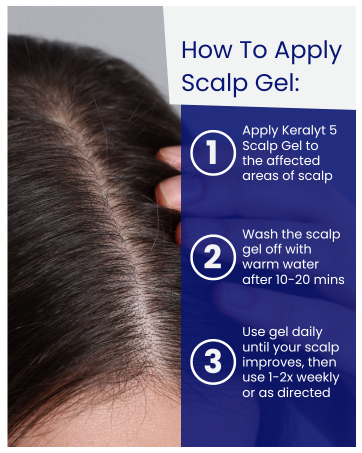 scalp gel