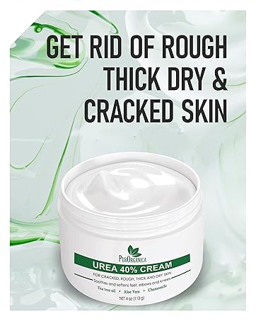 Urea Cream for rough thick cracked skin