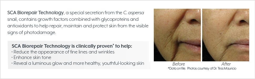 Factors of SCA Biorepair Technology