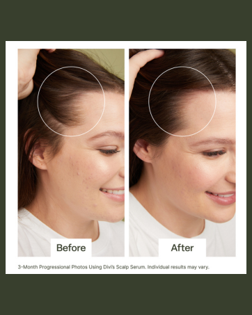 Serum Results