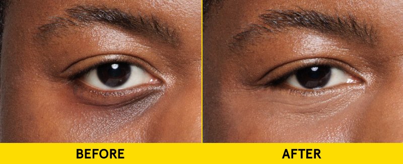 Dark Circle Corrector for Men 