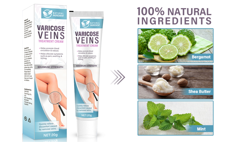 Varicose Veins Treatment for Legs