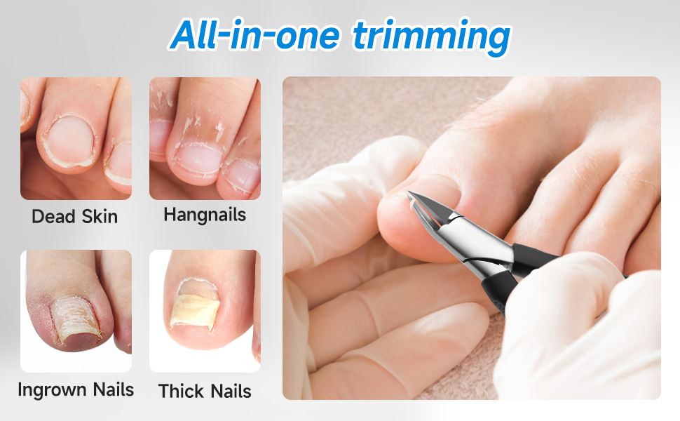 Ingrown Toenail Clippers