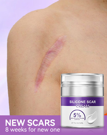 scar removal cream