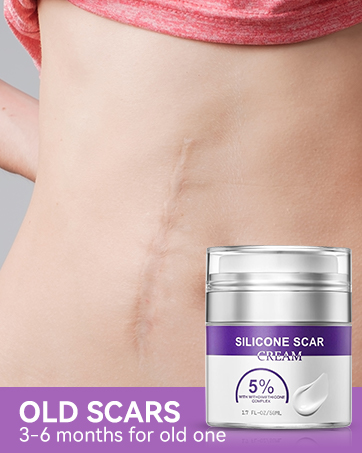 silagen scar gel