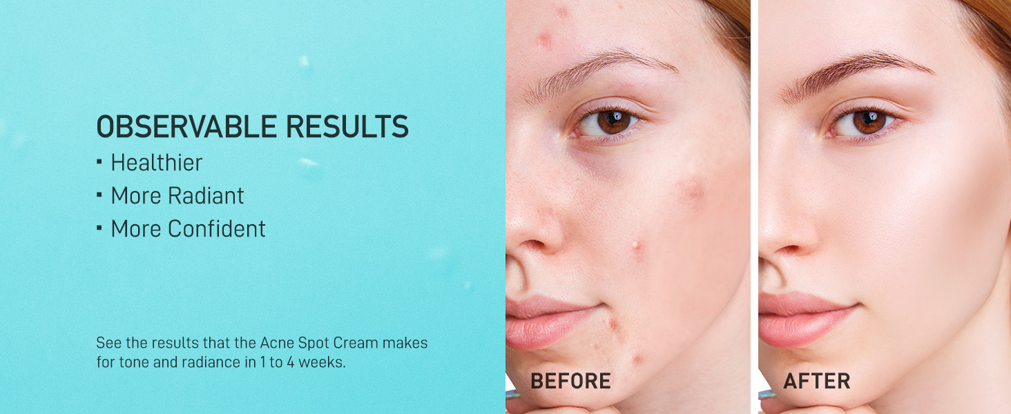 Effective acne spot solution