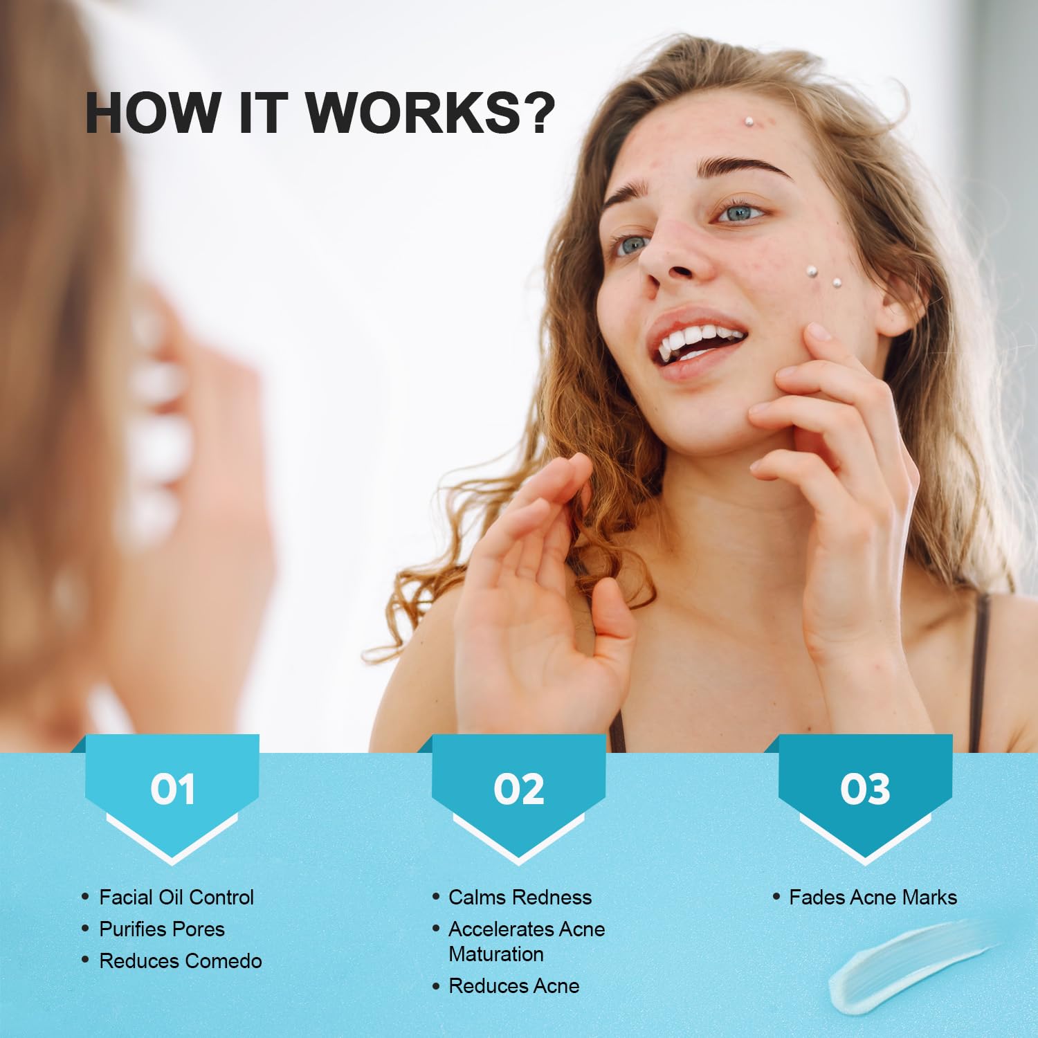 Cystic Acne Spot Treatment Cream for Face, Back and Body, Hormonal Pimple Scar Moisturizer Gel for Teens & Adults, Rapid Control and Clear Breakouts, 1.8 oz - Image 4