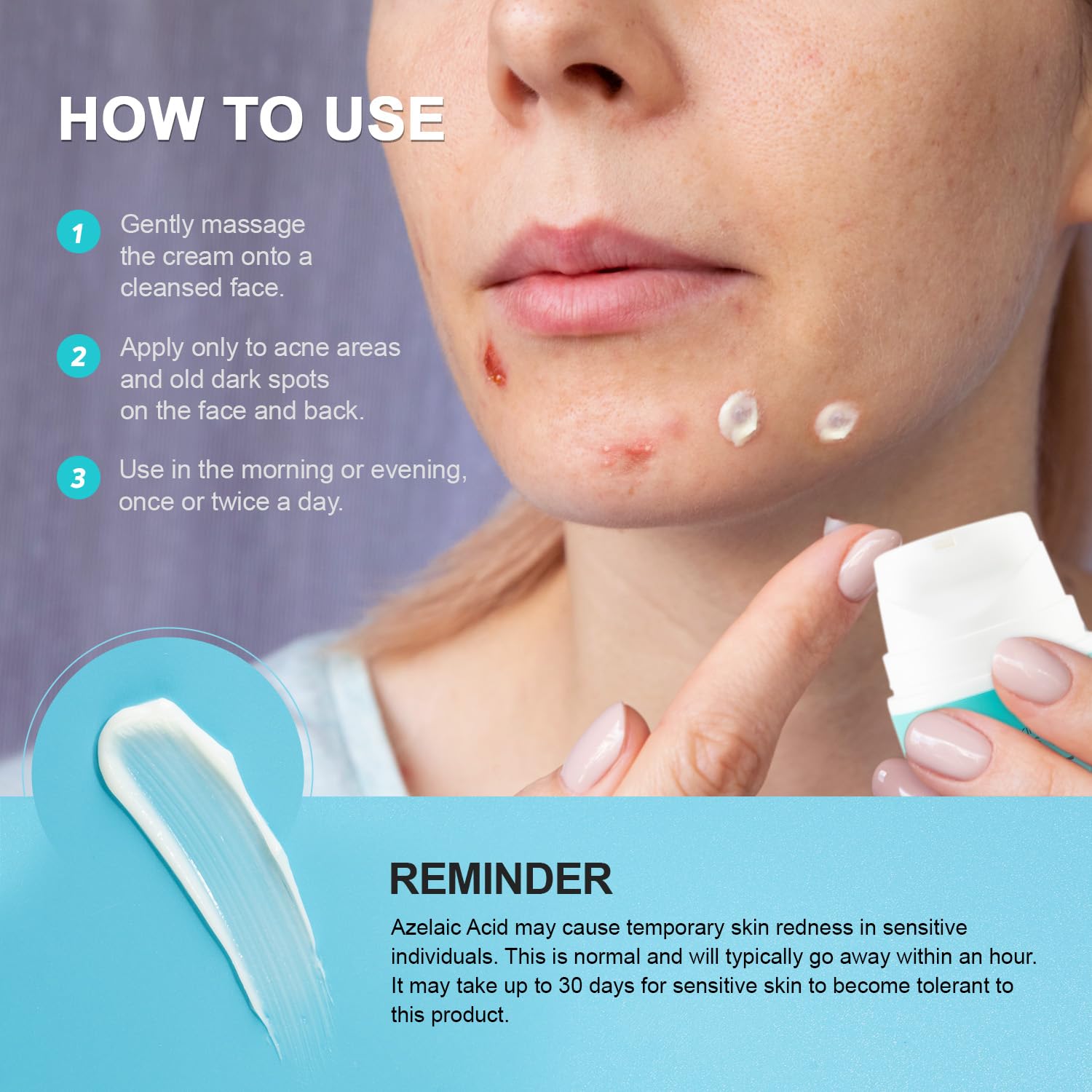 Cystic Acne Spot Treatment Cream for Face, Back and Body, Hormonal Pimple Scar Moisturizer Gel for Teens & Adults, Rapid Control and Clear Breakouts, 1.8 oz - Image 6