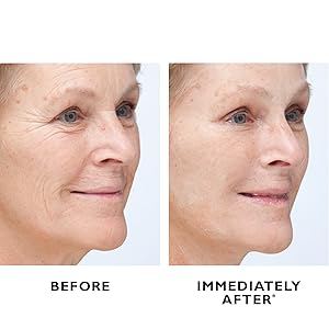 Peter Thomas Roth, Instant FIRMx Temporary Face Tightener, before and after B&A