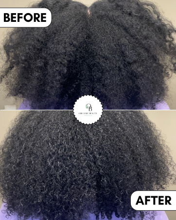 before/after