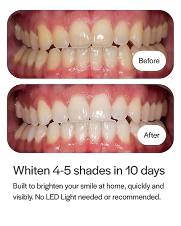 Before & After Image