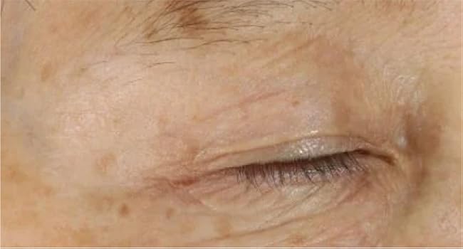 DEJ Eye Cream Before/After 3