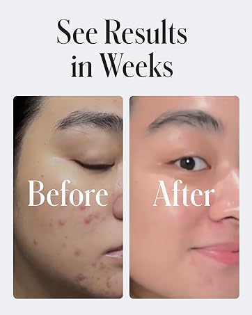 Geologie Skin Repair Moisturizer Face Cream Clear System Retinol