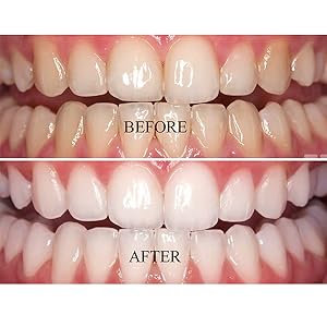 Before and after results