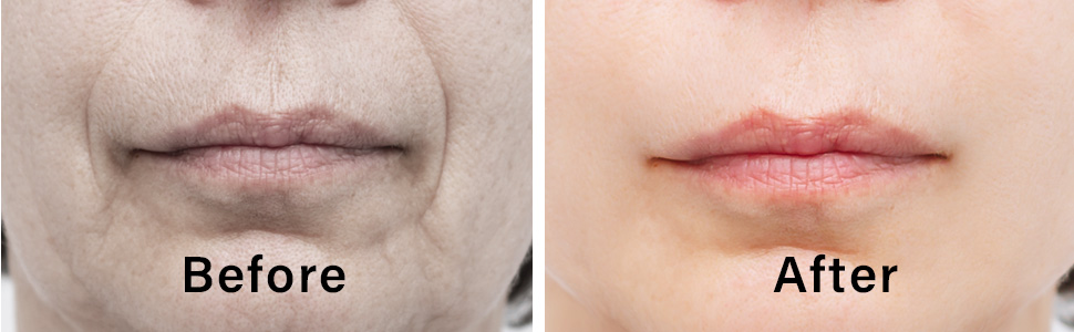 anti wrinkle patche