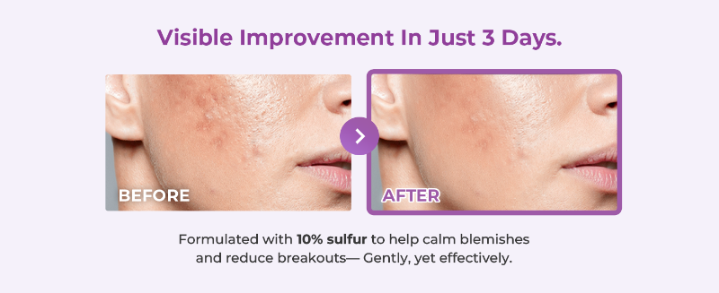 Glam Up Spotless Serum