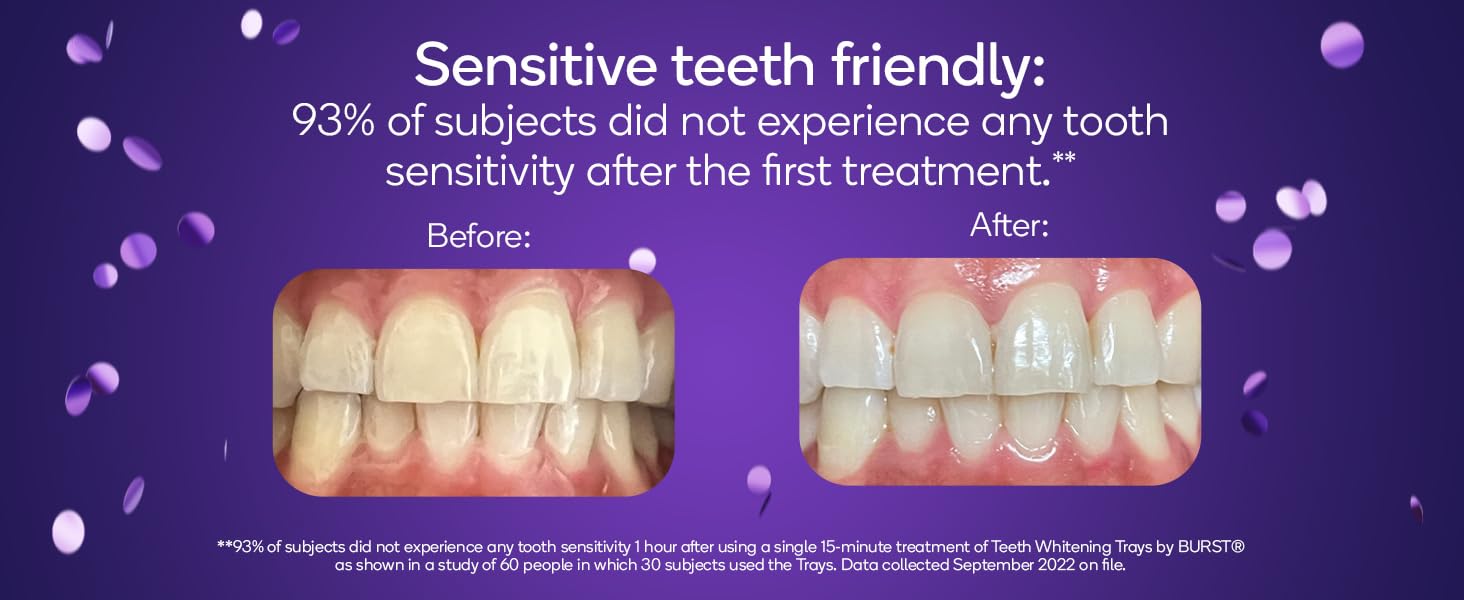 Sensitive teeth friendly whitening trays