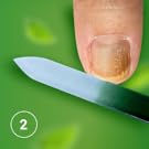 fungal nail treatment