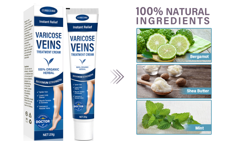 Varicose Veins Treatment for Legs