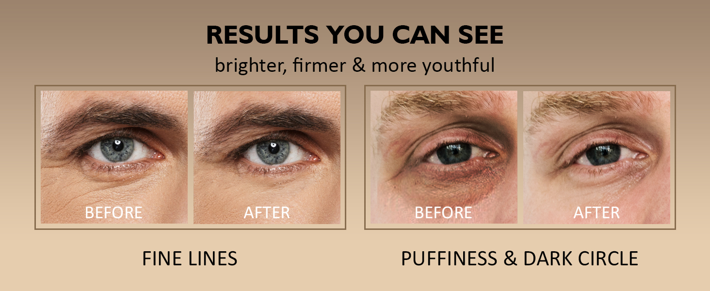 mens eye cream