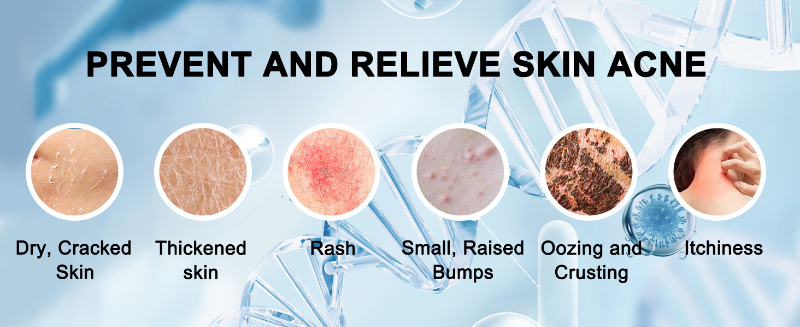 Eczema Wipes Image 4