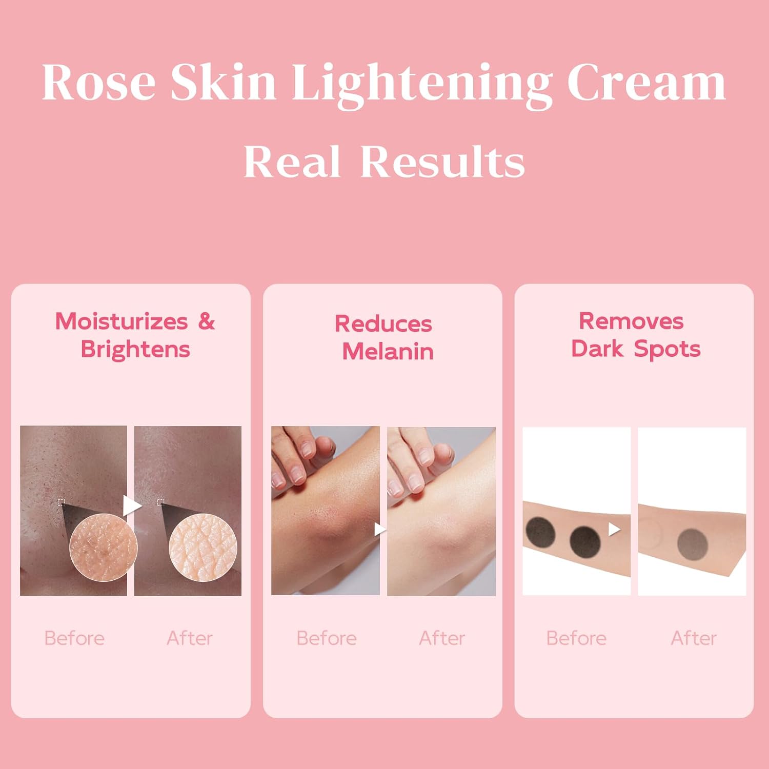 Brighten and Even Skin Tone Cream for Underarms, Elbows, Knees, and Intimate Areas 1.69 fl. oz - Image 2