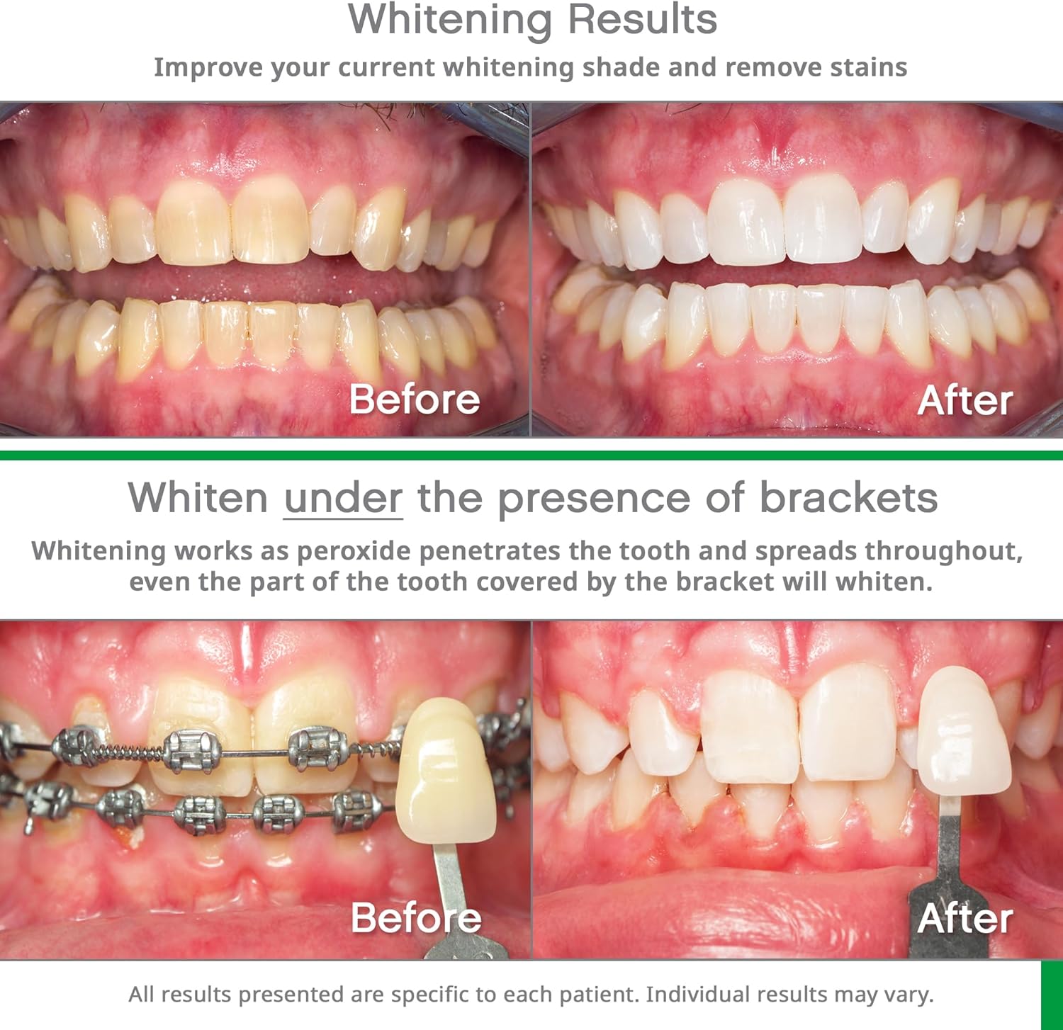 Opalescence Go 15% Hydrogen Peroxide Teeth Whitening Kit 10 Treatments Mint Flavor Sensitive Toothpaste 4.7 Oz - Image 4