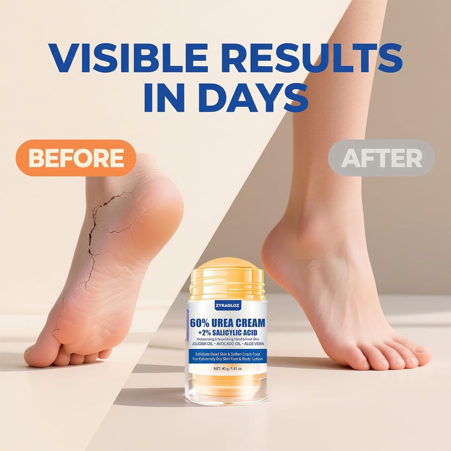 Urea Cream Stick 60% plus Salicylic Acid 2%, Maximum Strength Urea Foot Cream for Dry Cracked Heels, Feet Callus Remover, Hands Knees Exfoliating Dead Skin, Softening Skin Moisturizer Lotion - Image 4
