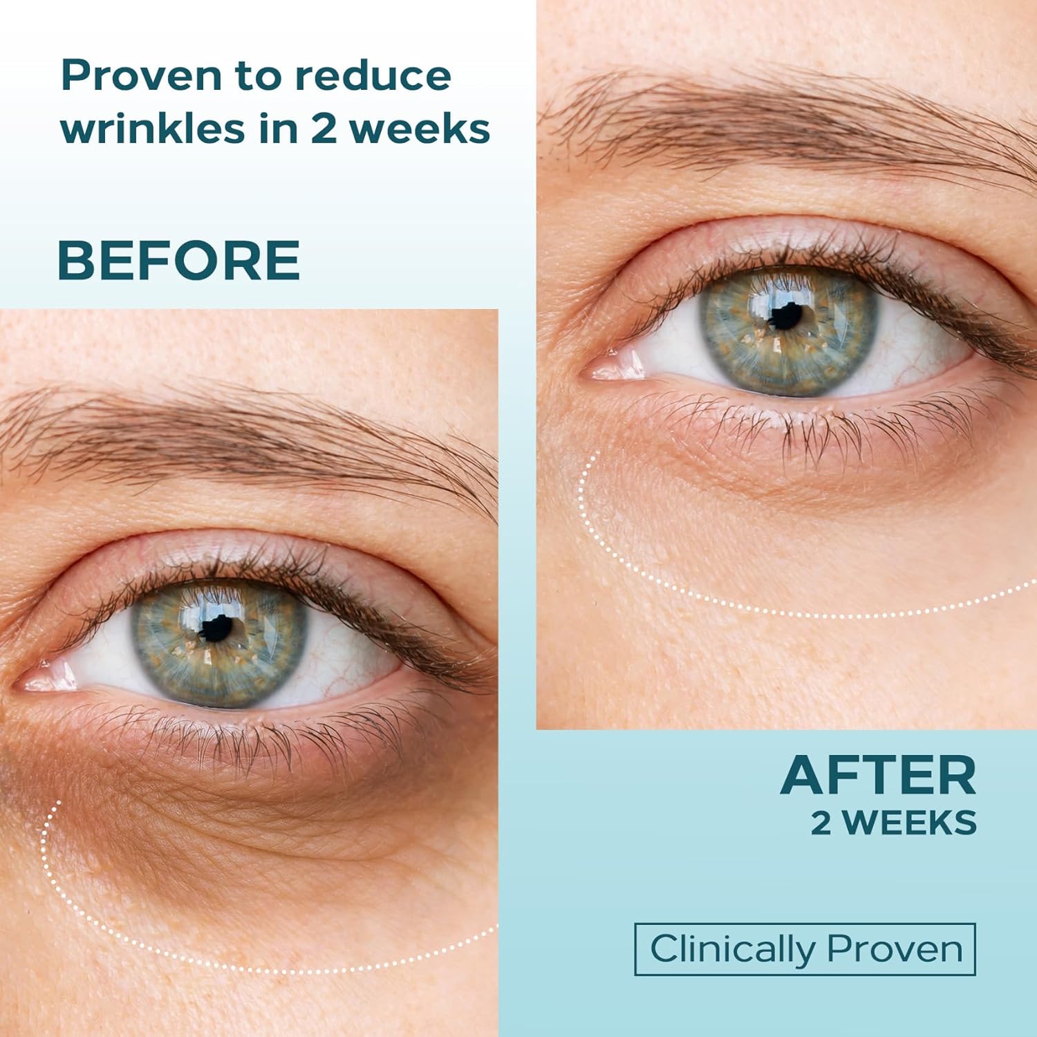 Elvira Dual Eye Cream 0.68 OZ with Stem Cell Extracts and Dual Retinol for Puffiness - Image 3