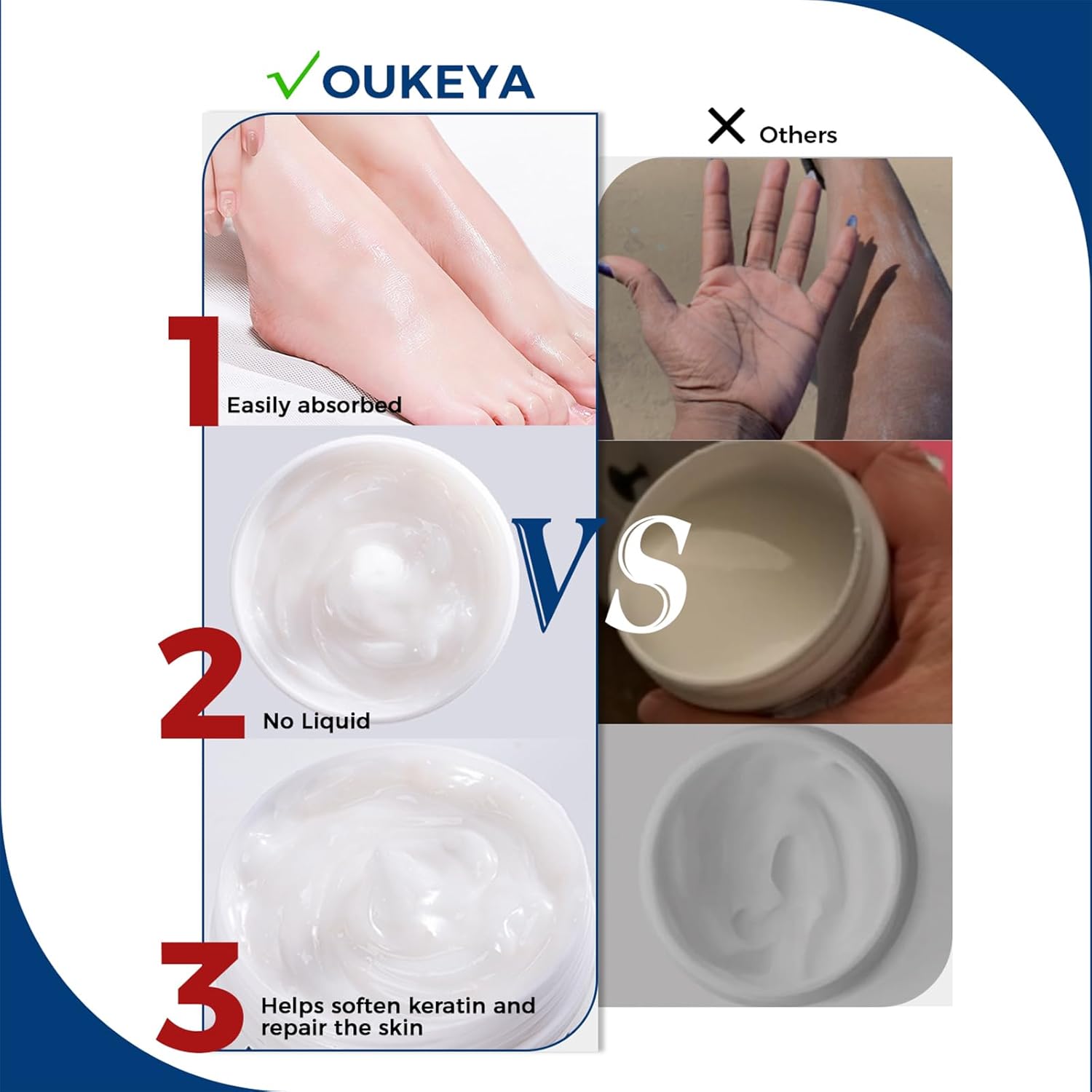 OUKEYA 40% Urea Cream 5.29 oz for Dry Cracked Feet and Hands Moisturizing Repair - Image 6