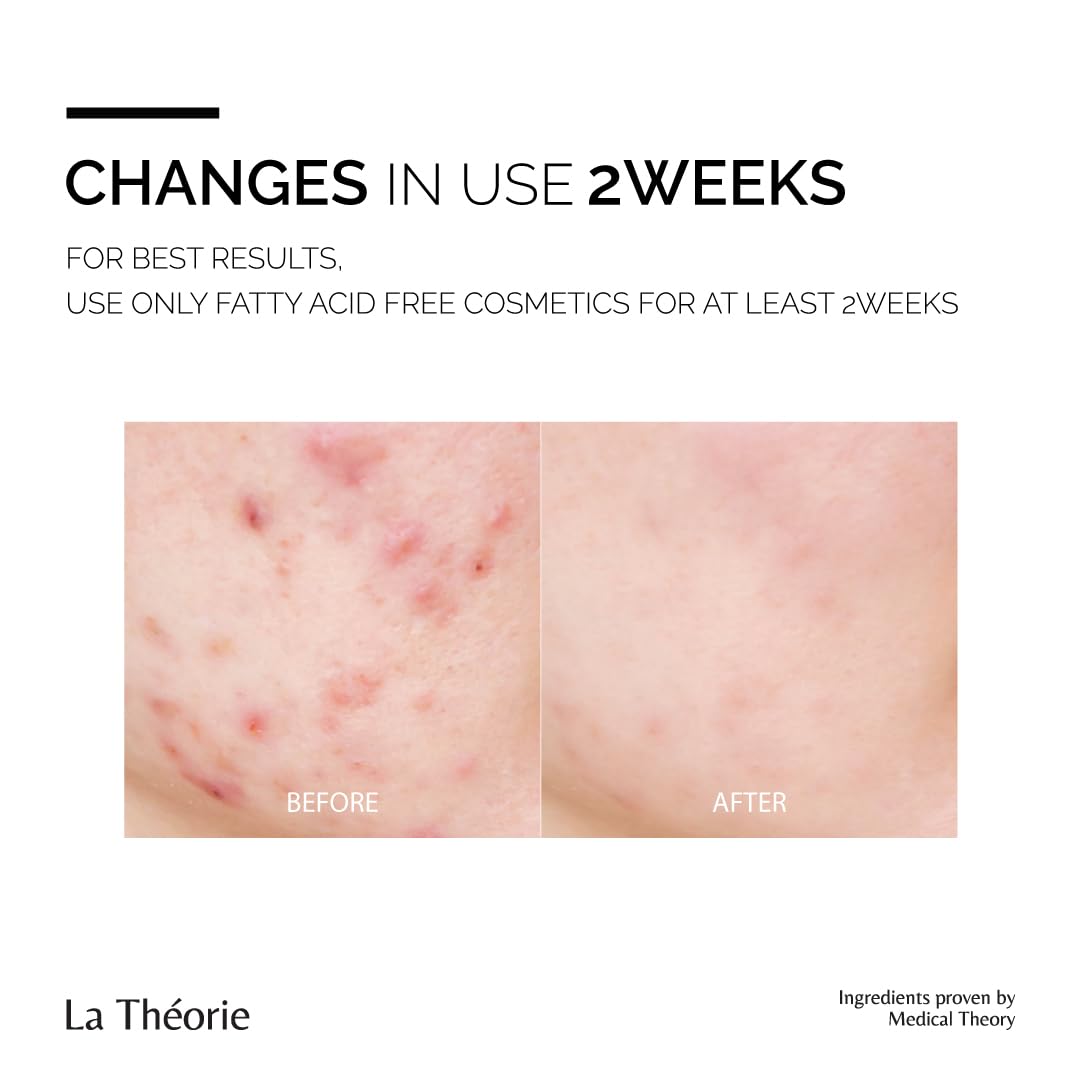 La Theorie Moisturizing(oil) Essence for troubled skin with fungal and small bumps (Fatty acid free, 1.01 Fl Oz) - Image 4