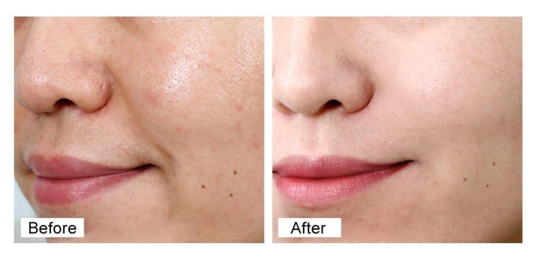 Retinol Plus+ Firming Anti-Aging Moisturizer 1.7 Fl Oz with Vitamin E, Collagen, Hyaluronic Acid - Image 2