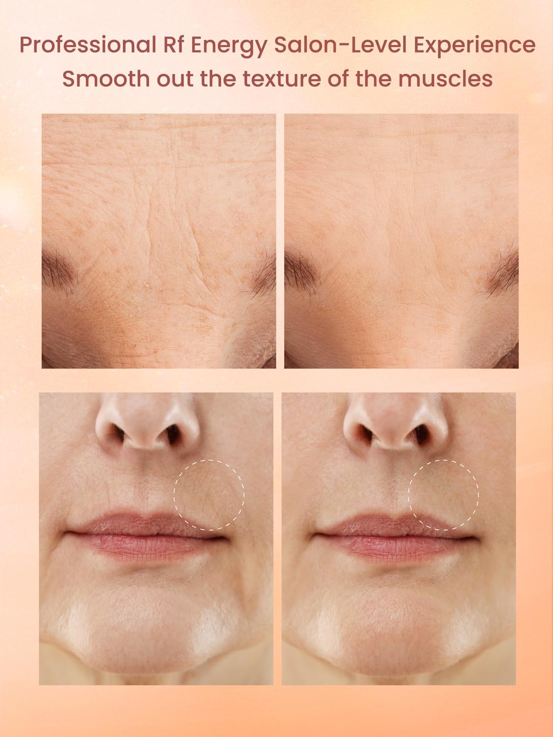 Radio Frequency Skin Tightening Device, Anti-Aging Face Machine for Wrinkle Removal, Lifting & Firming, Wireless Home Beauty Device with 3 Levels, at-Home Skin Renewal - Image 7