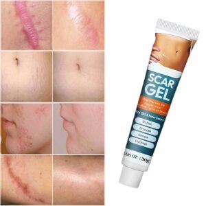 Scar Cream Advance Scar Gel for Surgical Scars, Burns, Acene, C-Section, Stretch Marks, Keloids, Scar Removal Cream for Old and New Scars, Suitable for Women Men Face Arm Leg Body - 1.06 Oz